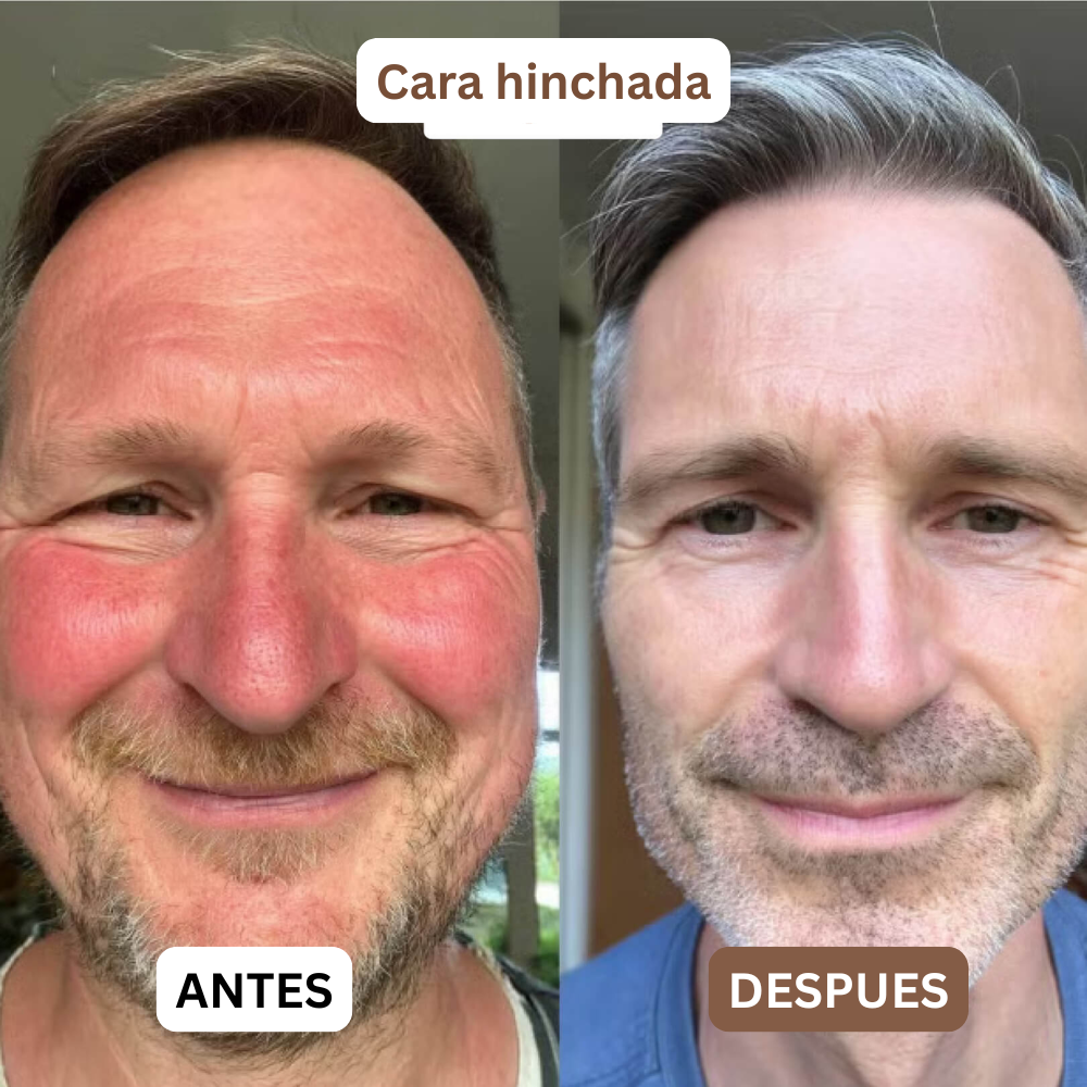 Complejo de órganos de res.